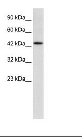 DLX2 Antibody - Jurkat Cell Lysate.  This image was taken for the unconjugated form of this product. Other forms have not been tested.