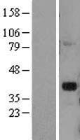 DLX2 Protein - Western validation with an anti-DDK antibody * L: Control HEK293 lysate R: Over-expression lysate
