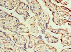 DLX3 Antibody - Immunohistochemistry of paraffin-embedded human placenta using antibody at 1:100 dilution.