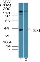 DLX3 Antibody - Western blot of DLX3 in NIH 3T3 cell lysates in the 1) absence and 2) presence of immunizing peptide using Polyclonal Antibody to DLX3 at 3 ug/ml. Goat anti-rabbit Ig HRP secondary antibody, and PicoTect ECL substrate solution, were used for this test.