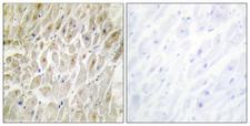 DLX3 Antibody - Immunohistochemistry analysis of paraffin-embedded human heart tissue, using DLX3 Antibody. The picture on the right is blocked with the synthesized peptide.