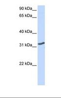 DLX3 Antibody - MCF7 cell lysate. Antibody concentration: 1.0 ug/ml. Gel concentration: 12%.  This image was taken for the unconjugated form of this product. Other forms have not been tested.
