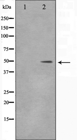 DLX3 Antibody - Western blot analysis on 293 cell lysates using DLX3 antibody. The lane on the left is treated with the antigen-specific peptide.