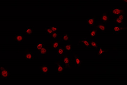 DLX3 Antibody - Staining 293 cells by IF/ICC. The samples were fixed with PFA and permeabilized in 0.1% Triton X-100, then blocked in 10% serum for 45 min at 25°C. The primary antibody was diluted at 1:200 and incubated with the sample for 1 hour at 37°C. An Alexa Fluor 594 conjugated goat anti-rabbit IgG (H+L) Ab, diluted at 1/600, was used as the secondary antibody.