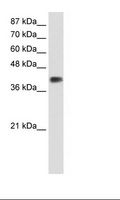 DLX3 Antibody - Transfected 293T Cell Lysate.  This image was taken for the unconjugated form of this product. Other forms have not been tested.