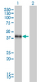 DLX3 Antibody - Western Blot analysis of DLX3 expression in transfected 293T cell line by DLX3 monoclonal antibody (M01), clone 4F8.Lane 1: DLX3 transfected lysate(32 KDa).Lane 2: Non-transfected lysate.