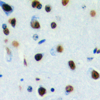 DLX3 Antibody - Immunohistochemical analysis of DLX3 staining in human brain formalin fixed paraffin embedded tissue section. The section was pre-treated using heat mediated antigen retrieval with sodium citrate buffer (pH 6.0). The section was then incubated with the antibody at room temperature and detected using an HRP conjugated compact polymer system. DAB was used as the chromogen. The section was then counterstained with hematoxylin and mounted with DPX.