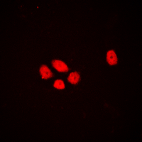 DLX3 Antibody - Immunofluorescent analysis of DLX3 staining in HEK293T cells. Formalin-fixed cells were permeabilized with 0.1% Triton X-100 in TBS for 5-10 minutes and blocked with 3% BSA-PBS for 30 minutes at room temperature. Cells were probed with the primary antibody in 3% BSA-PBS and incubated overnight at 4 deg C in a humidified chamber. Cells were washed with PBST and incubated with a DyLight 594-conjugated secondary antibody (red) in PBS at room temperature in the dark. DAPI was used to stain the cell nuclei (blue).
