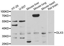 DLX3 Antibody - Western blot analysis of extracts of various cell lines.