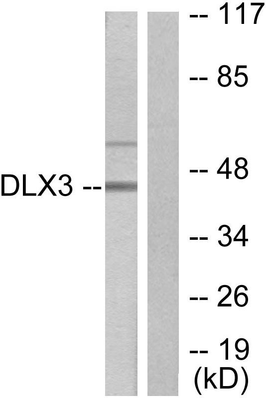 DLX3 Antibody - Western blot analysis of extracts from 293 cells, using DLX3 antibody.