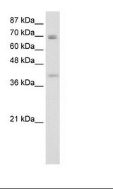 DLX3 Antibody - Transfected 293T Cell Lysate.  This image was taken for the unconjugated form of this product. Other forms have not been tested.