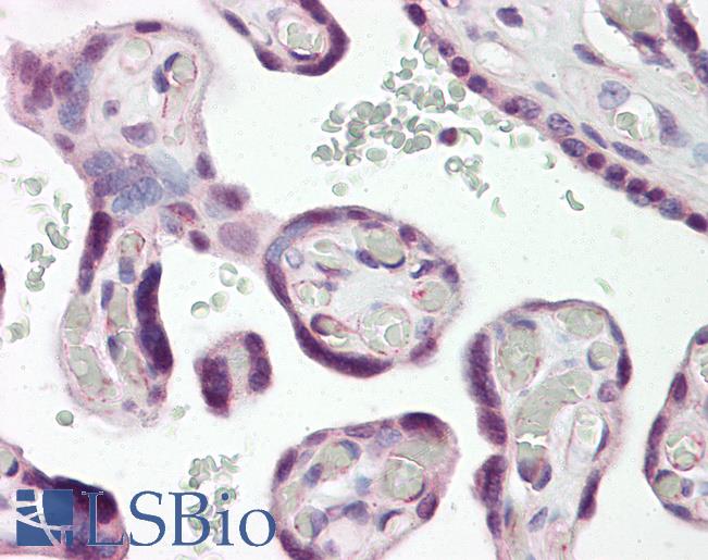 DLX3 Antibody - Anti-DLX3 antibody IHC of human placenta. Immunohistochemistry of formalin-fixed, paraffin-embedded tissue after heat-induced antigen retrieval. Antibody dilution 5-7.5 ug/ml.  This image was taken for the unconjugated form of this product. Other forms have not been tested.