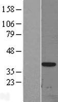 DLX3 Protein - Western validation with an anti-DDK antibody * L: Control HEK293 lysate R: Over-expression lysate