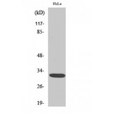DLX5 Antibody - Western blot of Dlx-5 antibody