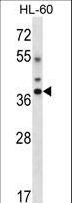 DLX5 Antibody - DLX5 Antibody western blot of HL-60 cell line lysates (35 ug/lane). The DLX5 antibody detected the DLX5 protein (arrow).