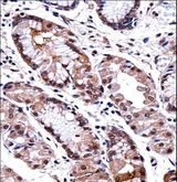 DLX5 Antibody - DLX5 Antibody immunohistochemistry of formalin-fixed and paraffin-embedded human stomach tissue followed by peroxidase-conjugated secondary antibody and DAB staining.