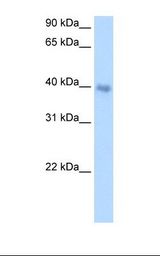 DLX5 Antibody - Transfected 293T cell lysate. Antibody concentration: 1.0 ug/ml. Gel concentration: 12%.  This image was taken for the unconjugated form of this product. Other forms have not been tested.