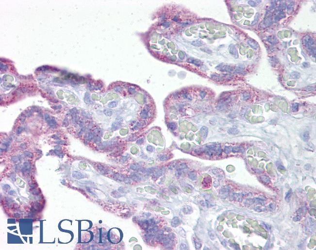 DLX5 Antibody - Human Placenta: Formalin-Fixed, Paraffin-Embedded (FFPE).  This image was taken for the unconjugated form of this product. Other forms have not been tested.
