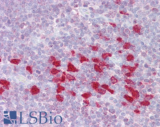 DLX5 Antibody - Anti-DLX5 antibody IHC of human thymus. Immunohistochemistry of formalin-fixed, paraffin-embedded tissue after heat-induced antigen retrieval. Antibody concentration 5 ug/ml.  This image was taken for the unconjugated form of this product. Other forms have not been tested.