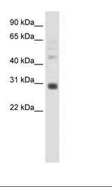 DLX5 Antibody - Placenta Lysate.  This image was taken for the unconjugated form of this product. Other forms have not been tested.