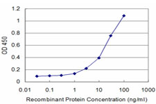 DLX5 Antibody - Detection limit for recombinant GST tagged DLX5 is approximately 3 ng/ml as a capture antibody.