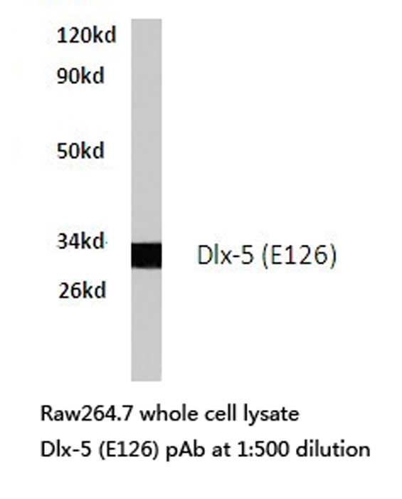 DLX5 Antibody - Western blot of Dlx-5 (E126) pAb in extracts from raw264.7 cells.