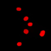 DLX5 Antibody - Immunofluorescent analysis of DLX5 staining in Raw264.7 cells. Formalin-fixed cells were permeabilized with 0.1% Triton X-100 in TBS for 5-10 minutes and blocked with 3% BSA-PBS for 30 minutes at room temperature. Cells were probed with the primary antibody in 3% BSA-PBS and incubated overnight at 4 C in a humidified chamber. Cells were washed with PBST and incubated with a DyLight 594-conjugated secondary antibody (red) in PBS at room temperature in the dark. DAPI was used to stain the cell nuclei (blue).