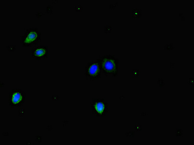 DLX5 Antibody - Immunofluorescent analysis of HepG2 cells diluted at 1:100 and Alexa Fluor 488-congugated AffiniPure Goat Anti-Rabbit IgG(H+L)