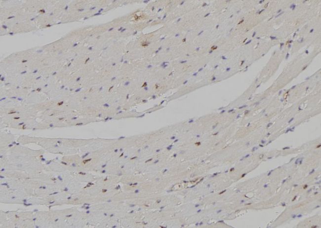 DLX5 Antibody - 1:100 staining mouse heart tissue by IHC-P. The sample was formaldehyde fixed and a heat mediated antigen retrieval step in citrate buffer was performed. The sample was then blocked and incubated with the antibody for 1.5 hours at 22°C. An HRP conjugated goat anti-rabbit antibody was used as the secondary.