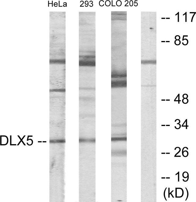 DLX5 Antibody - Western blot analysis of extracts from HeLa cells, 293 cells and COLO205 cells, using DLX5 antibody.