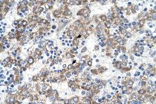 DLX5 Antibody - DLX5 antibody DLX5(distal-less homeobox 5) Antibody IHC of formalin-fixed, paraffin-embedded human Liver. Positive label: Hepatocytes indicated with arrows. Antibody concentration 4-8 ug/ml. Magnification 400X.  This image was taken for the unconjugated form of this product. Other forms have not been tested.