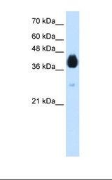 DLX5 Antibody - Transfected 293T cell lysate. Antibody concentration: 1.25 ug/ml. Gel concentration: 12%.  This image was taken for the unconjugated form of this product. Other forms have not been tested.