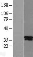 DLX5 Protein - Western validation with an anti-DDK antibody * L: Control HEK293 lysate R: Over-expression lysate