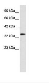 DLX6 Antibody - Jurkat Cell Lysate.  This image was taken for the unconjugated form of this product. Other forms have not been tested.