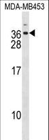 DLX6 Antibody - DLX6 Antibody western blot of MDA-MB453 cell line lysates (35 ug/lane). The DLX6 antibody detected the DLX6 protein (arrow).