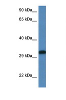 DLX6 Antibody - DLX6 antibody Western blot of Rat Muscle lysate. Antibody concentration 1 ug/ml.  This image was taken for the unconjugated form of this product. Other forms have not been tested.