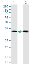 DLX6 Antibody - Western Blot analysis of DLX6 expression in transfected 293T cell line by DLX6 monoclonal antibody (M06), clone 2D7.Lane 1: DLX6 transfected lysate(19.708 KDa).Lane 2: Non-transfected lysate.
