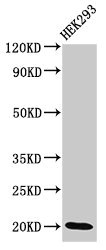 DLX6 Antibody - Positive Western Blot detected in HEK293 whole cell lysate. All lanes: DLX6 antibody at 3.4 µg/ml Secondary Goat polyclonal to rabbit IgG at 1/50000 dilution. Predicted band size: 20, 30, 33 KDa. Observed band size: 20 KDa