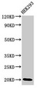 DLX6 Antibody - Positive Western Blot detected in HEK293 whole cell lysate. All lanes: DLX6 antibody at 3.4 µg/ml Secondary Goat polyclonal to rabbit IgG at 1/50000 dilution. Predicted band size: 20, 30, 33 KDa. Observed band size: 20 KDa