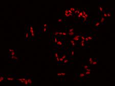 DLX6 Antibody - Immunofluorescence staining of DLX6 in SHSY5Y cells. Cells were fixed with 4% PFA, permeabilzed with 0.1% Triton X-100 in PBS, blocked with 10% serum, and incubated with rabbit anti-Human DLX6 polyclonal antibody (dilution ratio 1:200) at 4°C overnight. Then cells were stained with the Alexa Fluor 594-conjugated Goat Anti-rabbit IgG secondary antibody (red). Positive staining was localized to Nucleus.