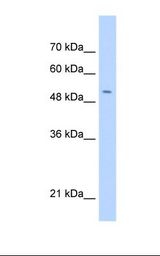 DM4E3 / C11orf24 Antibody - HepG2 cell lysate. Antibody concentration: 0.5 ug/ml. Gel concentration: 12%.  This image was taken for the unconjugated form of this product. Other forms have not been tested.