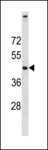 DM4E3 / C11orf24 Antibody - C11orf24 Antibody western blot of SK-BR-3 cell line lysates (35 ug/lane). The C11orf24 antibody detected the C11orf24 protein (arrow).