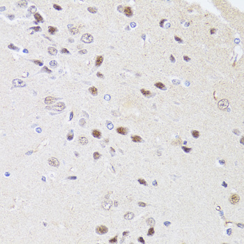 DMAP1 Antibody - Immunohistochemistry of paraffin-embedded rat brain tissue.