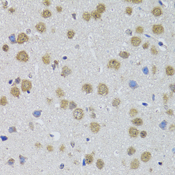 DMAP1 Antibody - Immunohistochemistry of paraffin-embedded mouse brain tissue.