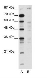 DMAP1 Antibody - A: Marker, B: Jurkat Cell Lysate.  This image was taken for the unconjugated form of this product. Other forms have not been tested.
