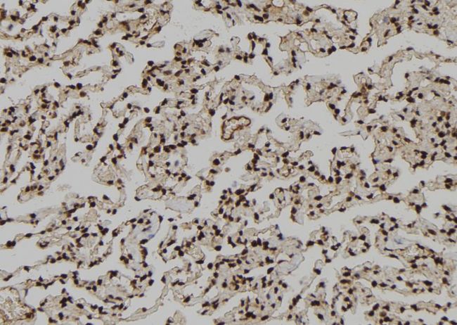DMAP1 Antibody - 1:100 staining human lung tissue by IHC-P. The sample was formaldehyde fixed and a heat mediated antigen retrieval step in citrate buffer was performed. The sample was then blocked and incubated with the antibody for 1.5 hours at 22°C. An HRP conjugated goat anti-rabbit antibody was used as the secondary.