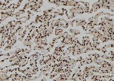DMAP1 Antibody - 1:100 staining human lung tissue by IHC-P. The sample was formaldehyde fixed and a heat mediated antigen retrieval step in citrate buffer was performed. The sample was then blocked and incubated with the antibody for 1.5 hours at 22°C. An HRP conjugated goat anti-rabbit antibody was used as the secondary.