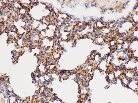 DMBT1 Antibody - Immunohistochemistry of paraffin-embedded Mouse lung using DMBT1 Polycloanl Antibody at dilution of 1:300