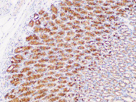 DMBT1 Antibody - Immunohistochemistry of paraffin-embedded Rat stomach using DMBT1 Polycloanl Antibody at dilution of 1:300