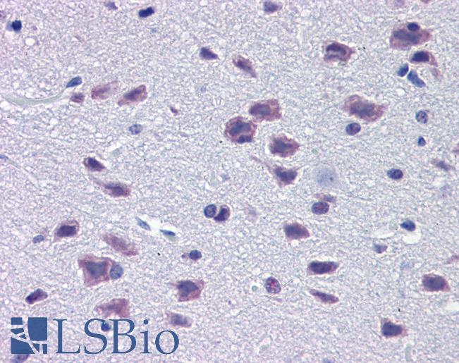 DMBX1 / OTX3 Antibody - Anti-DMBX1 / OTX3 antibody IHC of mouse brain. Immunohistochemistry of formalin-fixed, paraffin-embedded tissue after heat-induced antigen retrieval. Antibody concentration 5 ug/ml.  This image was taken for the unconjugated form of this product. Other forms have not been tested.